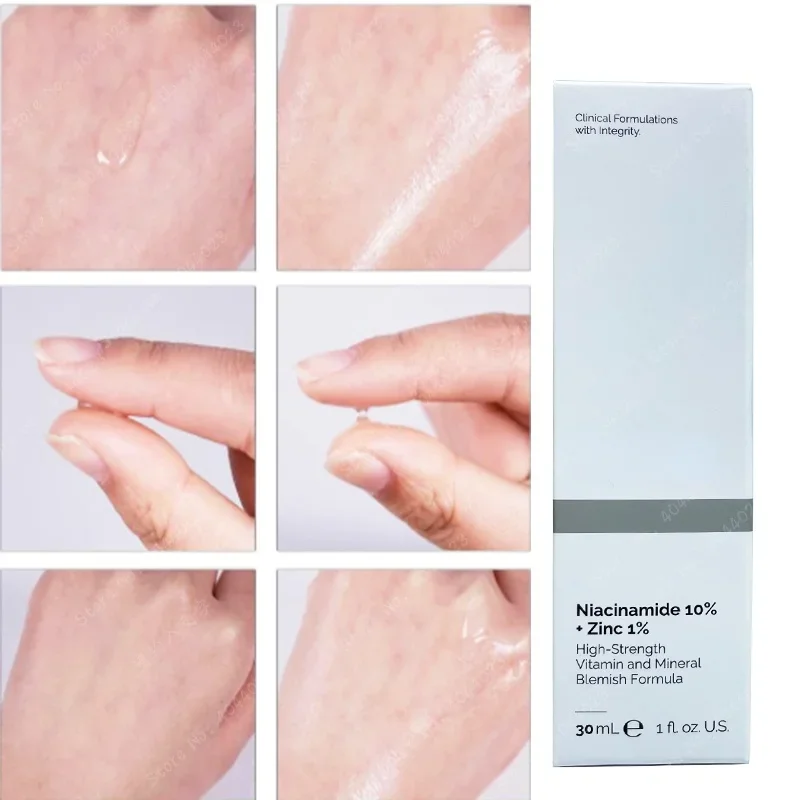 Ниацинамидная магниевая отбели – обзор и цена Niacinamide Pore Shrinking Essence