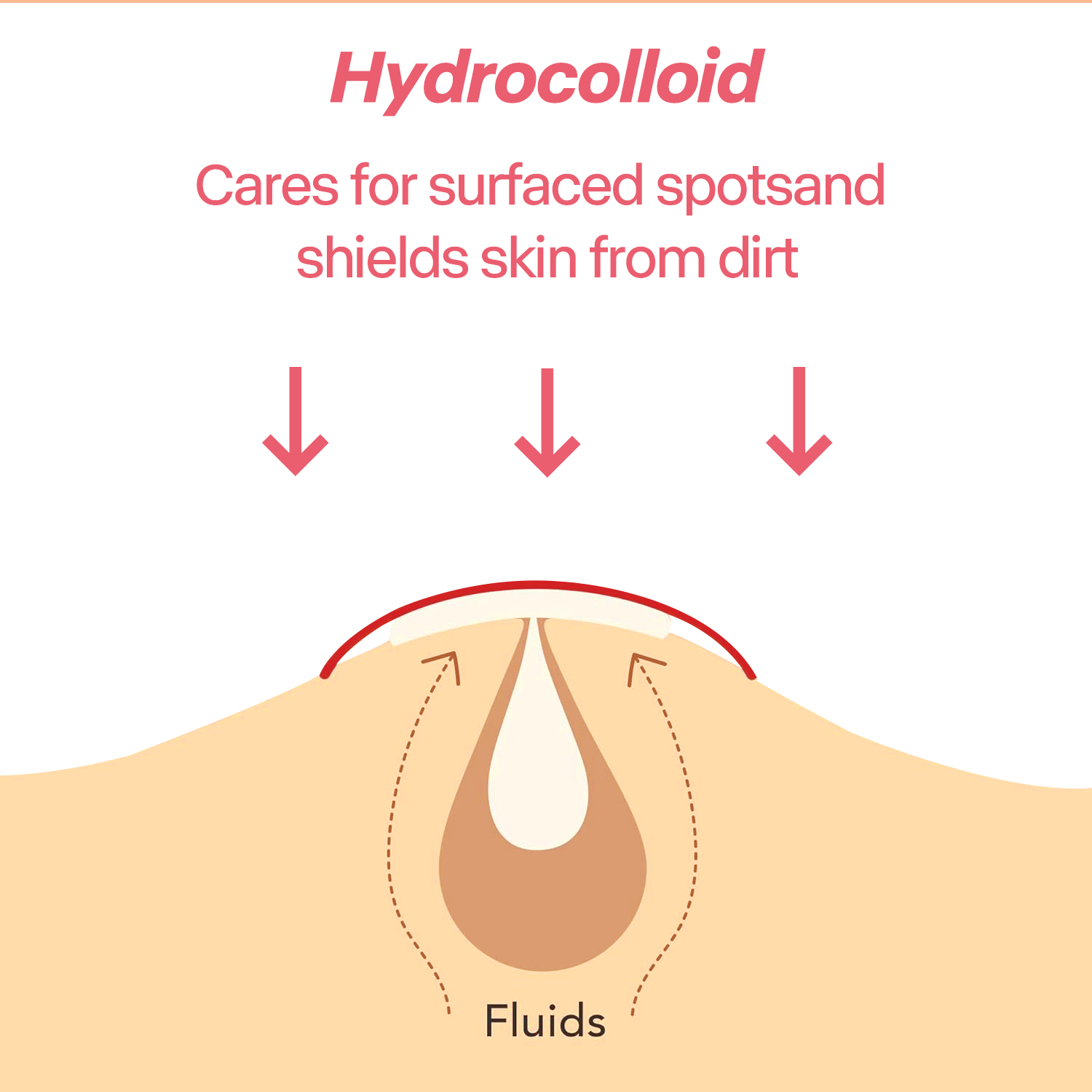 216 шт., пластыри от прыщей с  – обзор и цена Salicylic Acid Blackhead Remover
